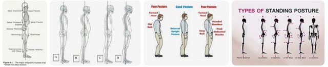 Postural Alignment Device That Floats Your Spine, Not Forces It